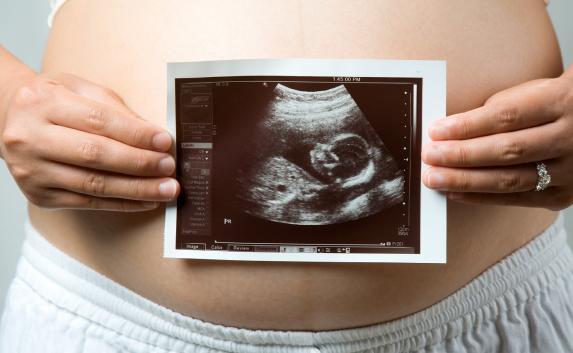 Общественная палата предлагает разрешить врачам отказываться от проведения абортов