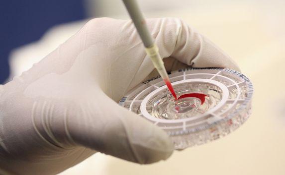 Вирус Эбола в крови россиянок не обнаружен
