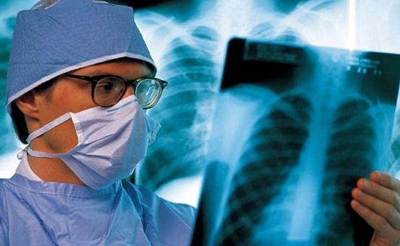 Заболеваемость туберкулёзом в городе ниже, чем была при Украине