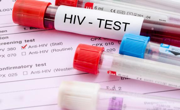 Каждого пятого крымчанина проверят на ВИЧ в 2017 году