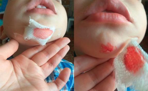 В севастопольской поликлинике не оказали помощь ребёнку с травмой