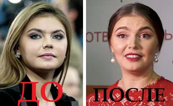Интернет обсуждает «новое лицо» Алины Кабаевой