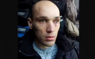 Слепой из Джанкоя обвинил депутата ГД в избиении из-за плевка (фото)