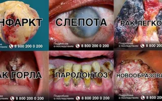 Россиян-курильщиков на пачках сигарет ждут новые «страшилки»