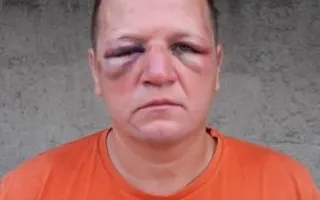 СМИ: полицейские избили мужчину в Севастополе (фото, видео)